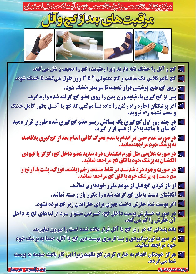 مراقبت های بعد از گچ گیری